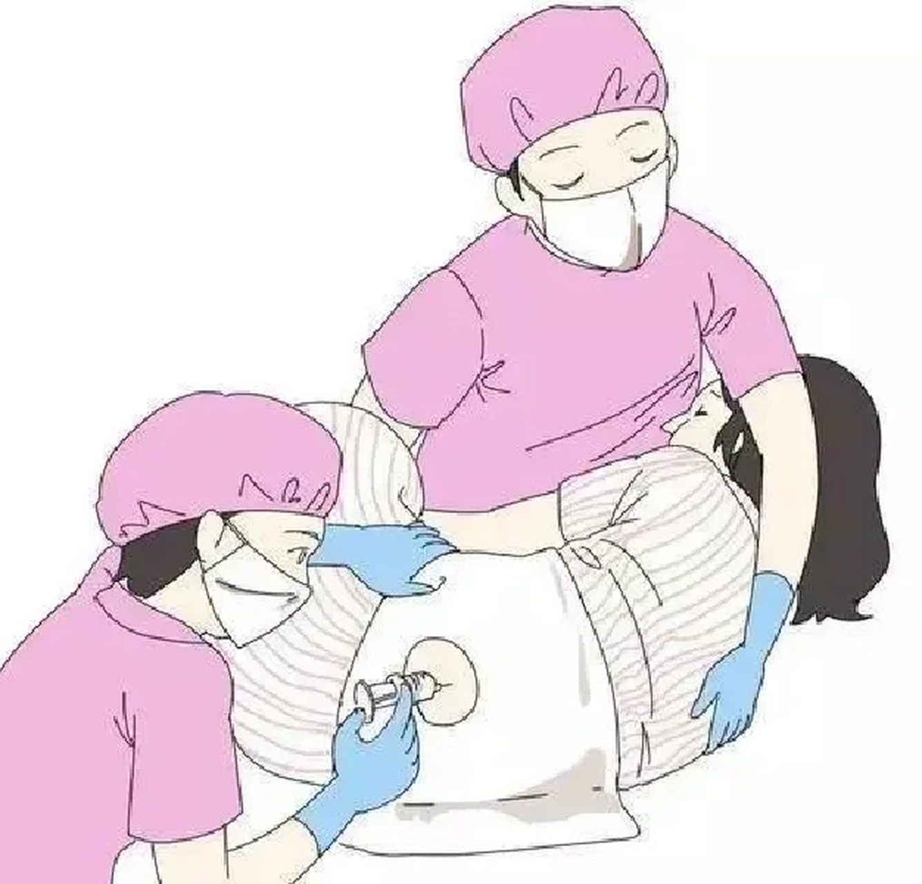 剖腹产腰部麻醉真的不痛!