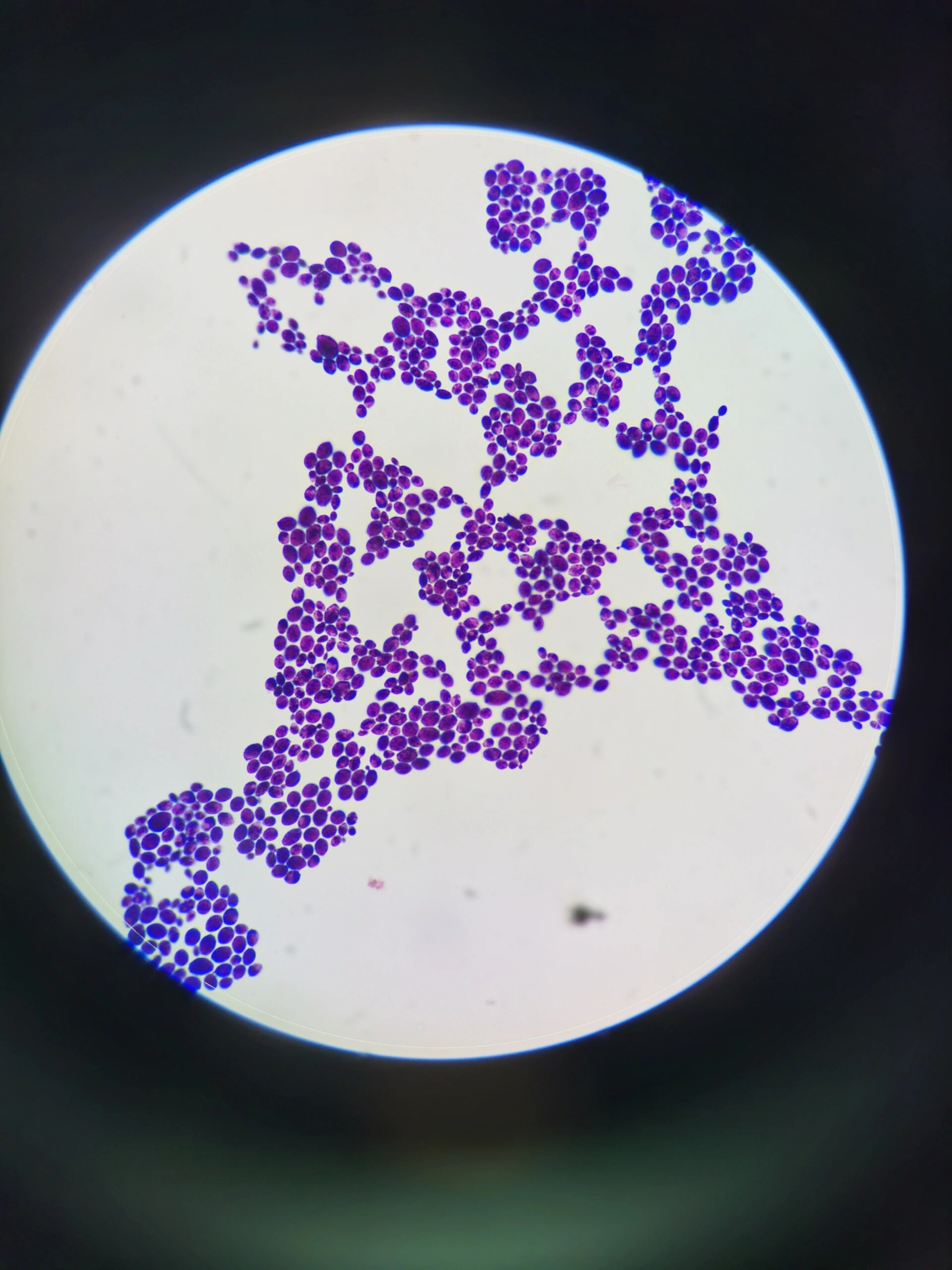 白念革兰染色镜下长这样↑ 瓜子样,白色念珠菌
