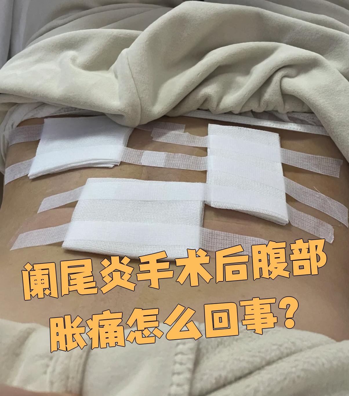 阑尾炎手术后腹部胀痛可能和胃肠功能没恢复伴发肠梗阻或炎症感染