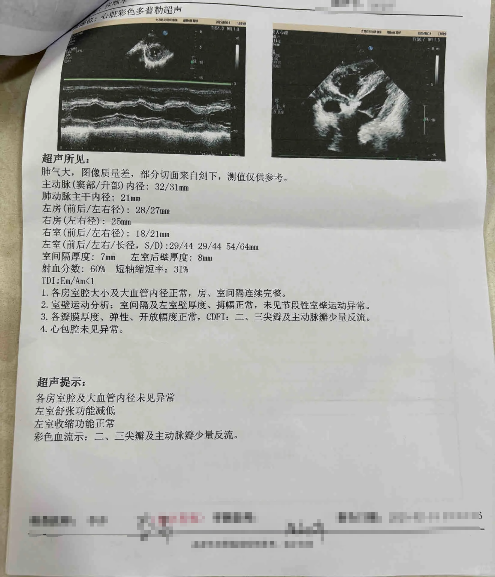 心脏射血分数是衡量心脏泵血功能的重要指标