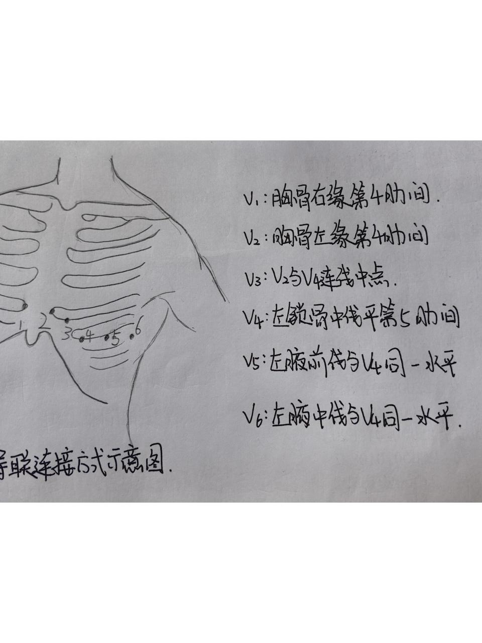 心前区导联连接方式示意图及位置