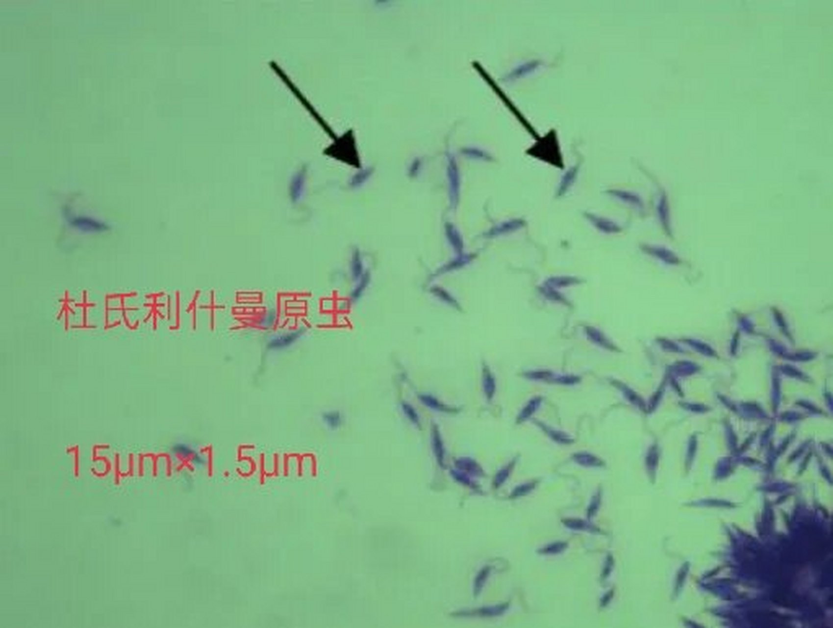 day11杜氏利什曼原虫