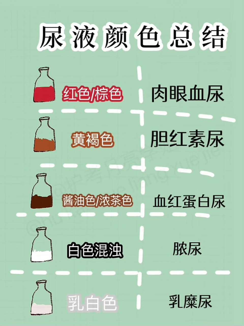 96黄褐色—胆红素 96酱油色/浓茶色—血红蛋白尿 96白色混浊