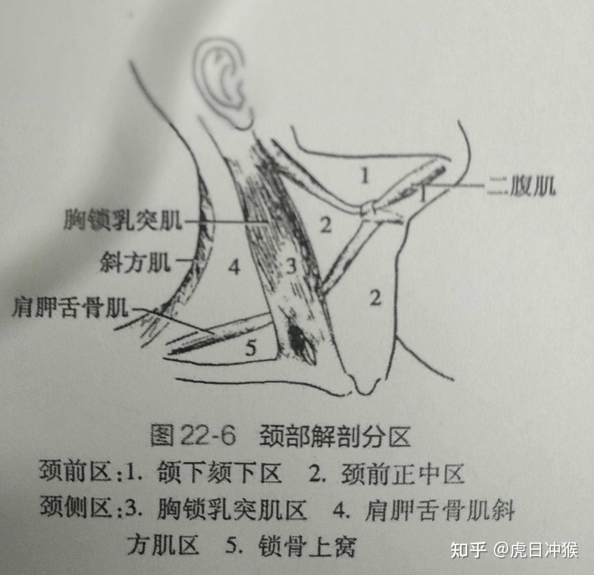 胸锁乳突肌位置图图片