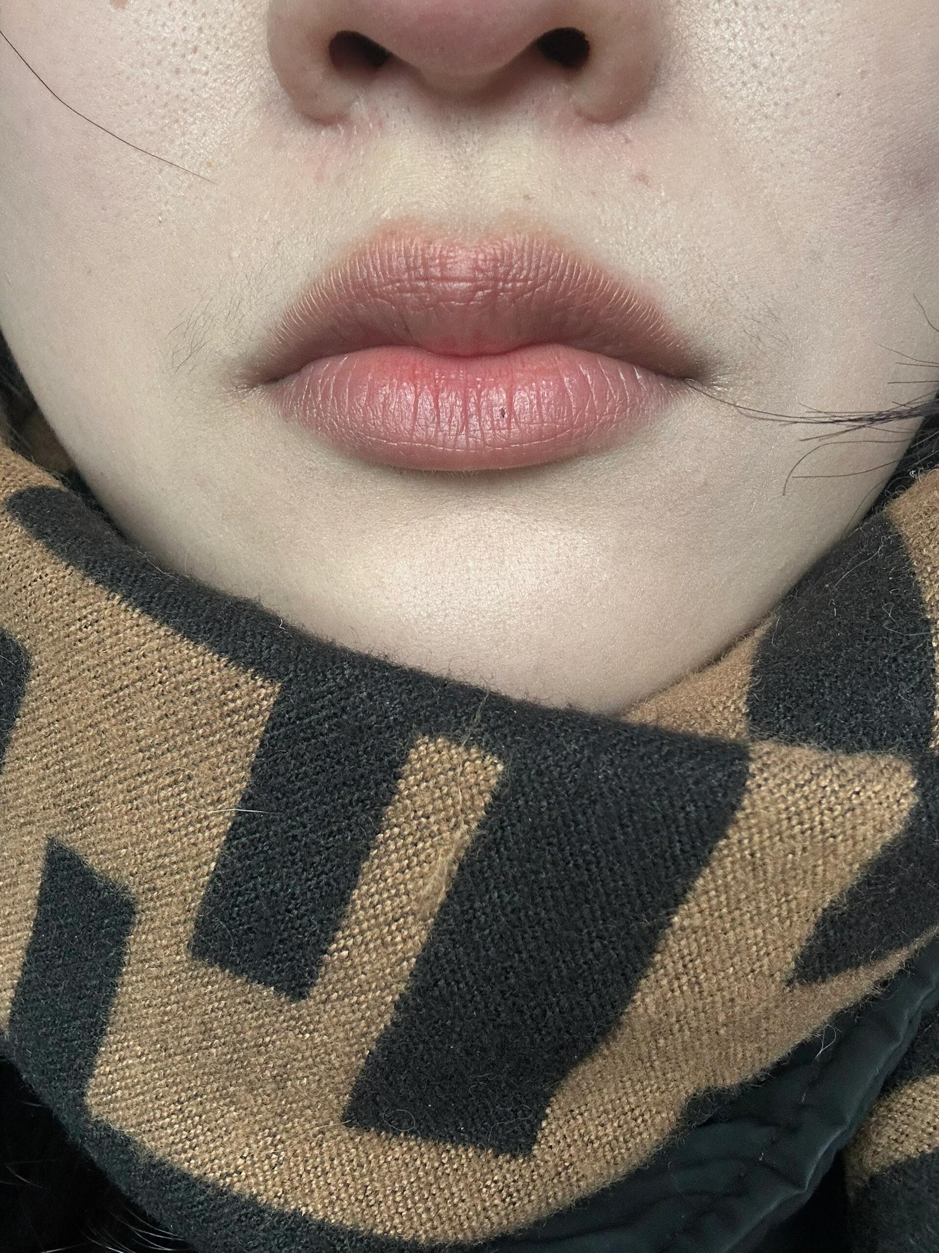 唇纹深图片纹嘴唇1一7天图片真人纹唇18天效果图片真人纹嘴唇15天图片