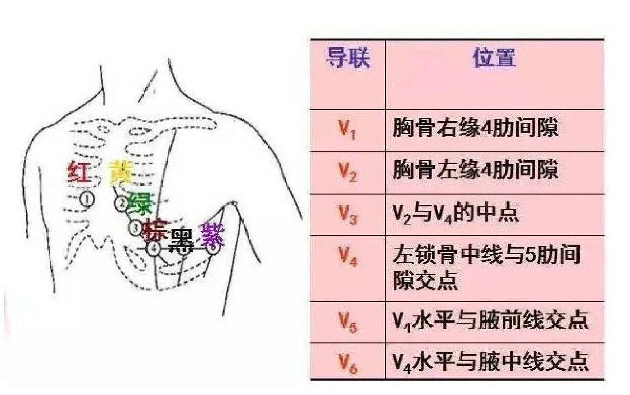 多通道十二导联心电图图片