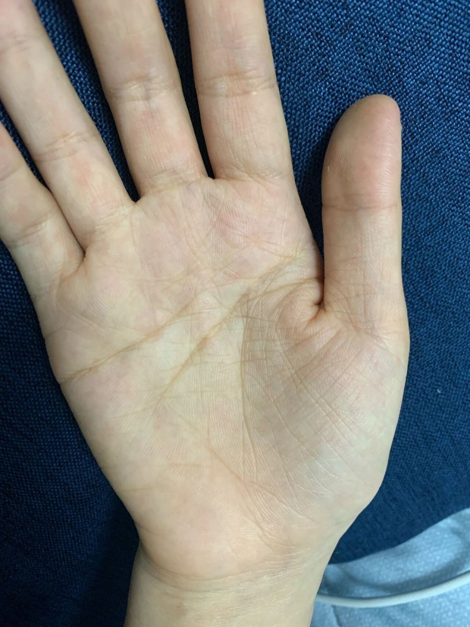 为什么我有两条"生命线"? 代表有两条"ming"吗?