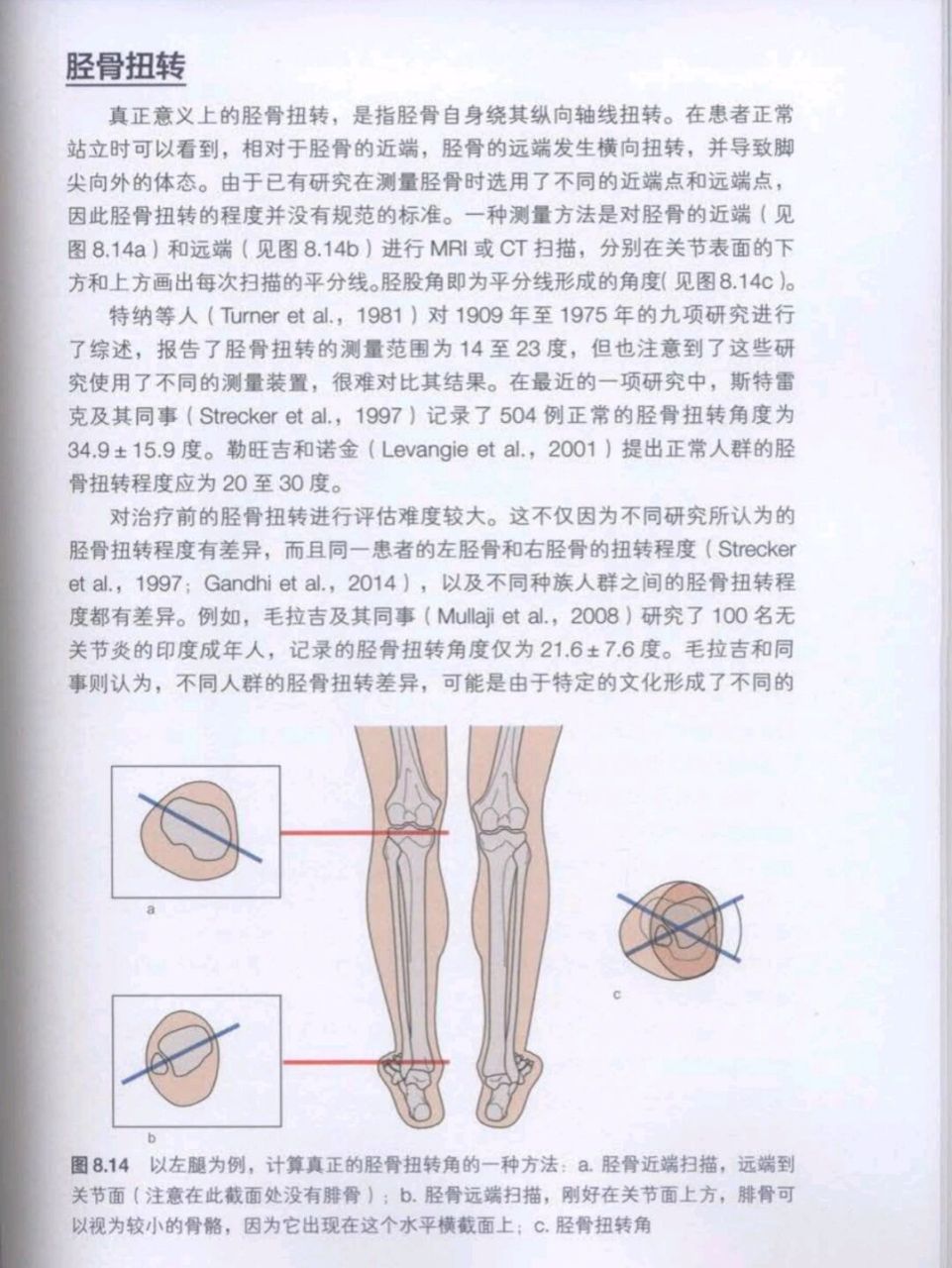 1:小腿外旋,一般右腿比左腿更加严重一些,观看你小腿胫骨粗隆位置是否