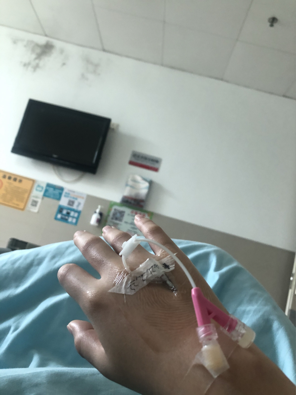 住院闲来无事 说下宫外孕手术的经历吧 26岁第一次怀孕 连续监测了3次
