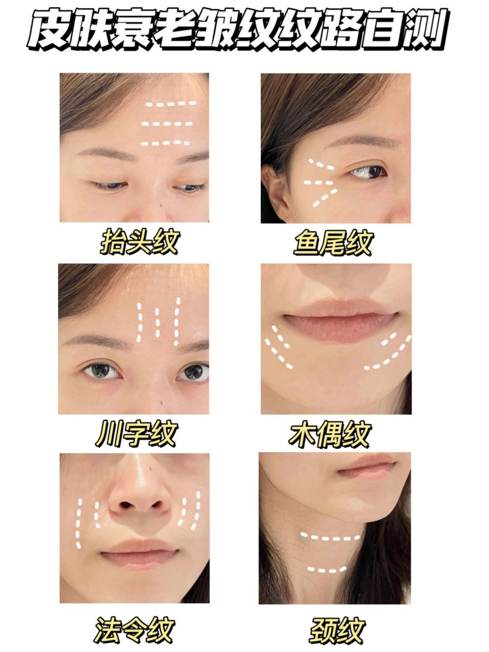 垮丑脸如何逆袭紧密好皮 肌肤皱纹纹路自测!