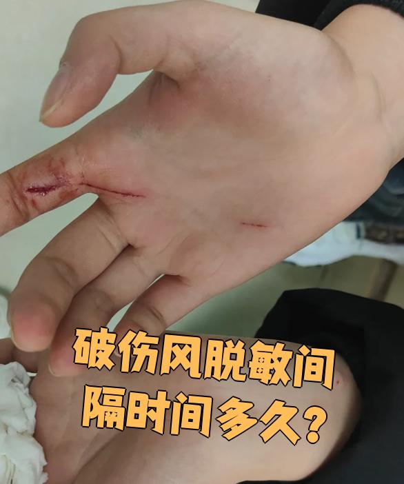 破伤风脱敏间隔时间多久