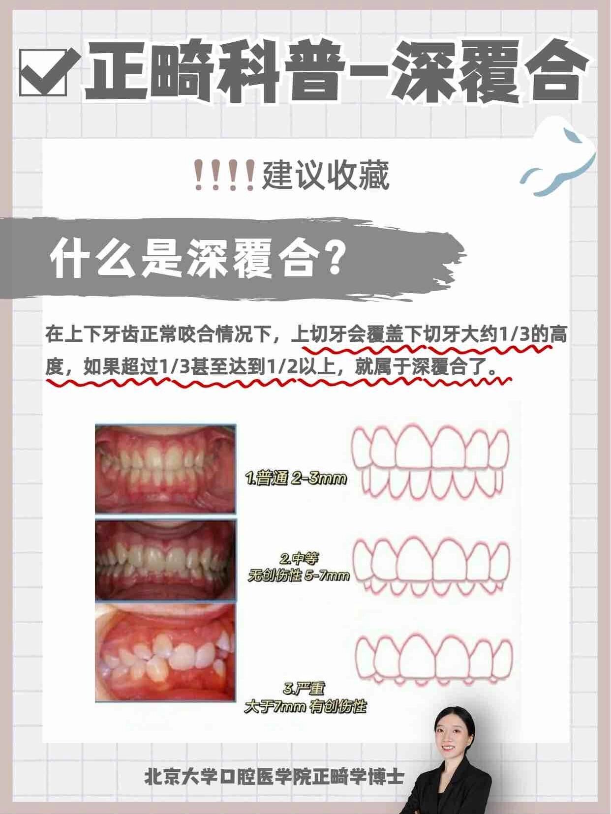 什么是深覆合?有什么危害?