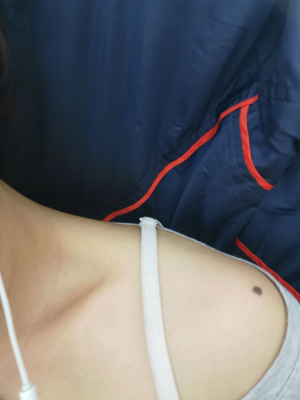 肩有痣,穷一世? 人的命运真的是注定好了的吗?