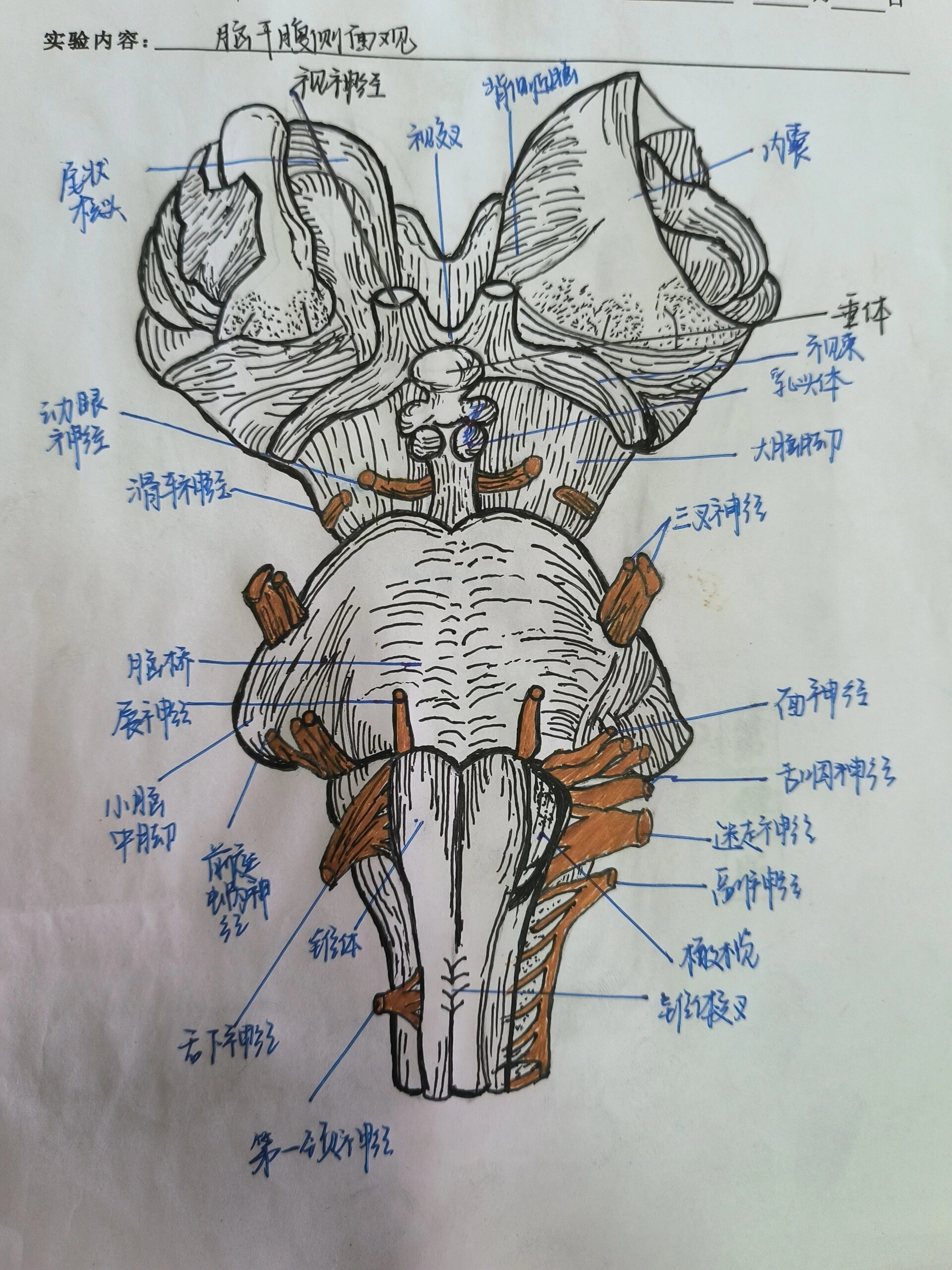 脑干腹侧面的结构图图片