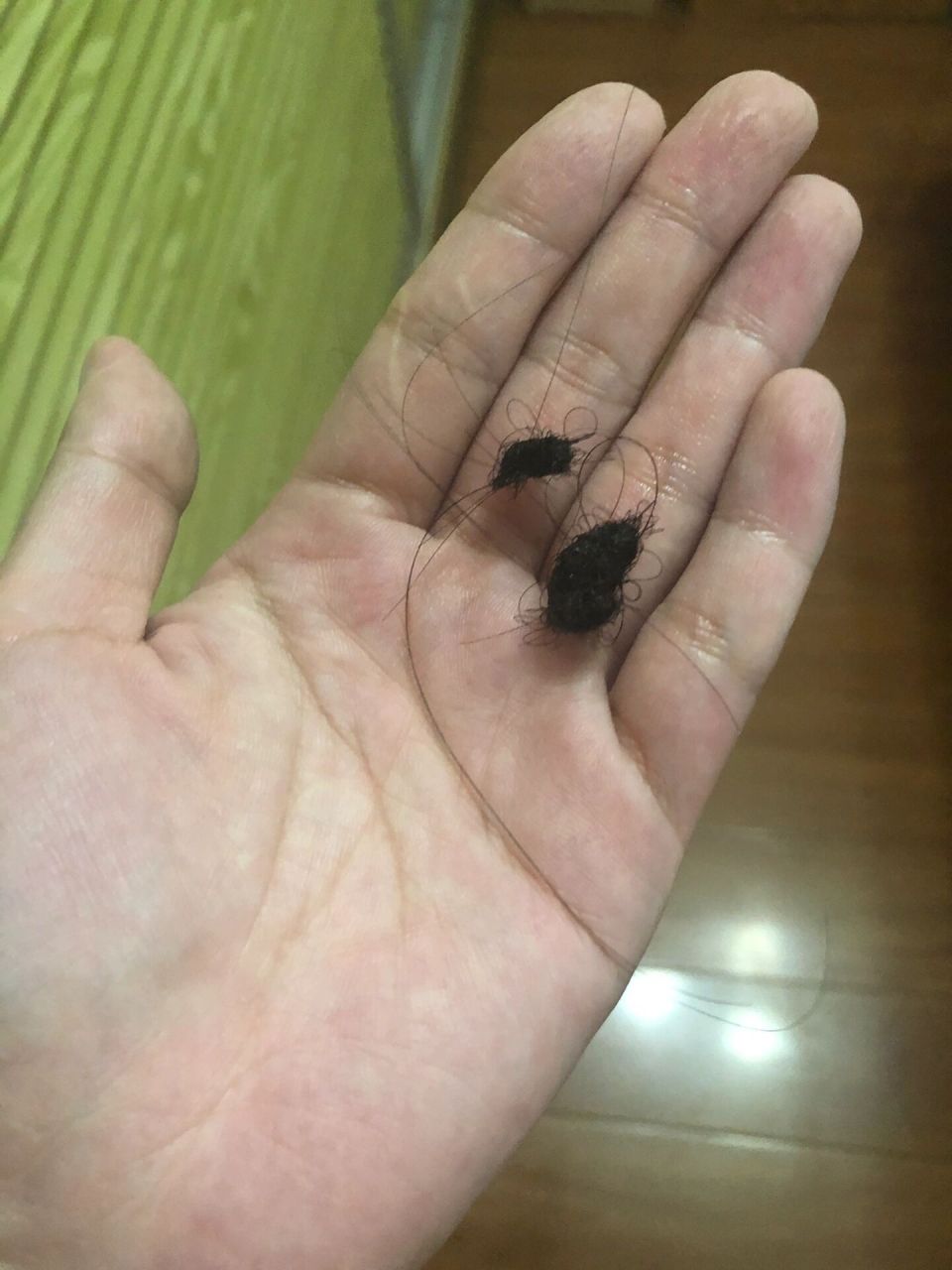 成都殊德中医馆皮肤科张颜老师确实厉害 哇咔咔 不知道是不是心里作用