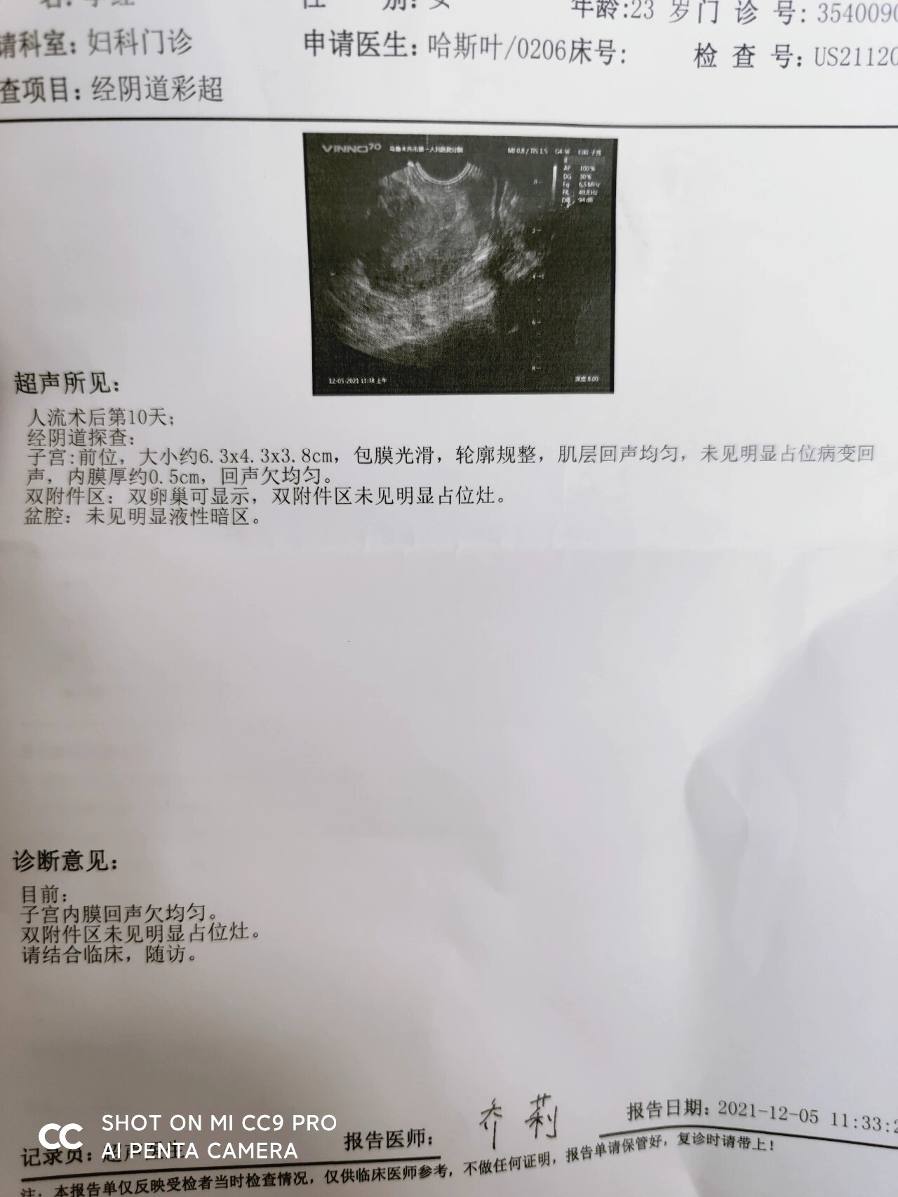 人流第十天复查