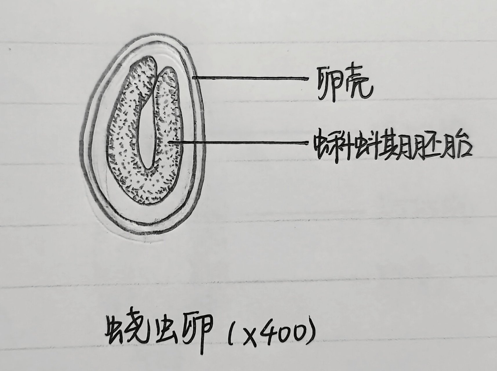 蛔虫卵结构图图片