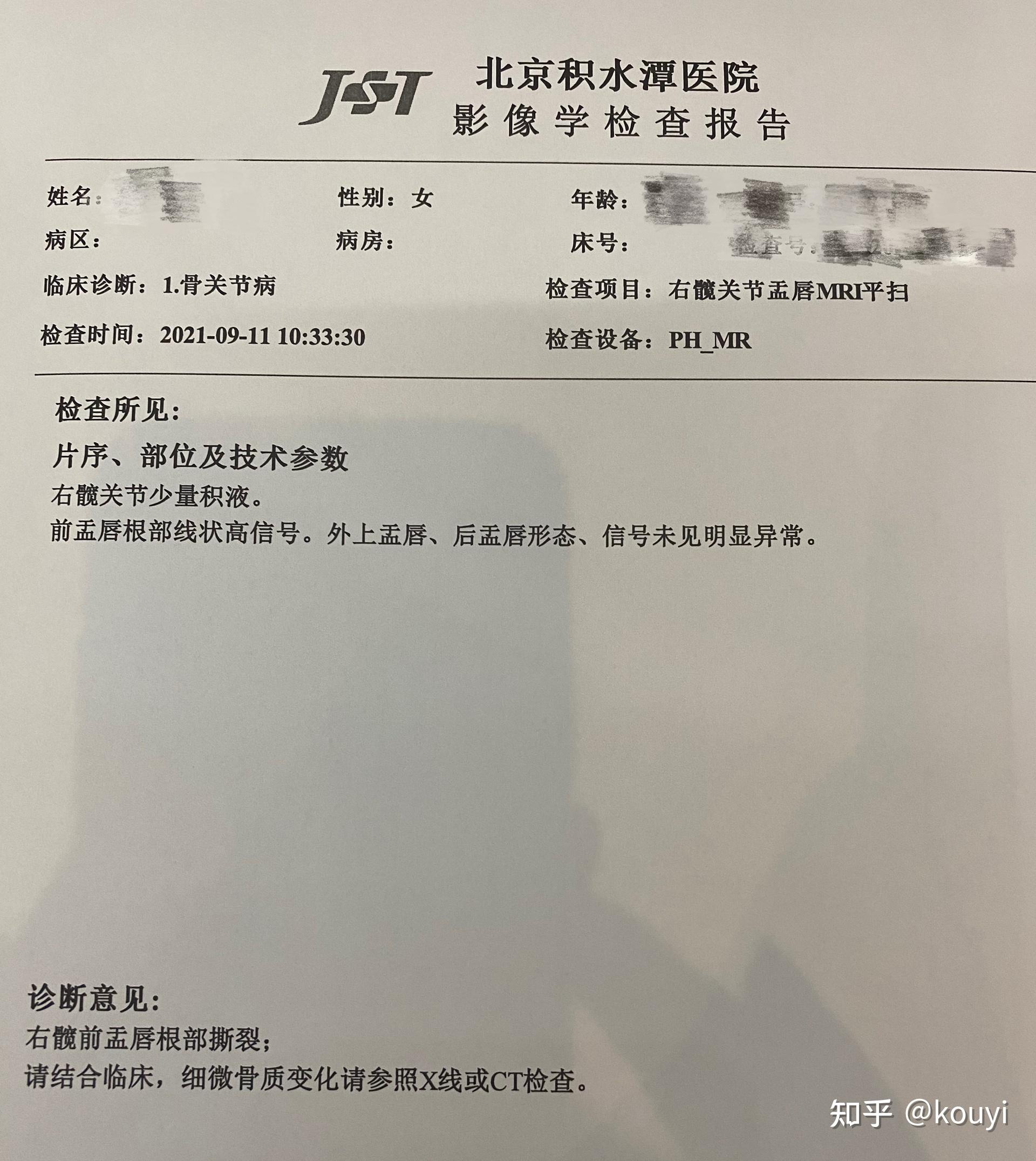 髋关节发育不良求医历程