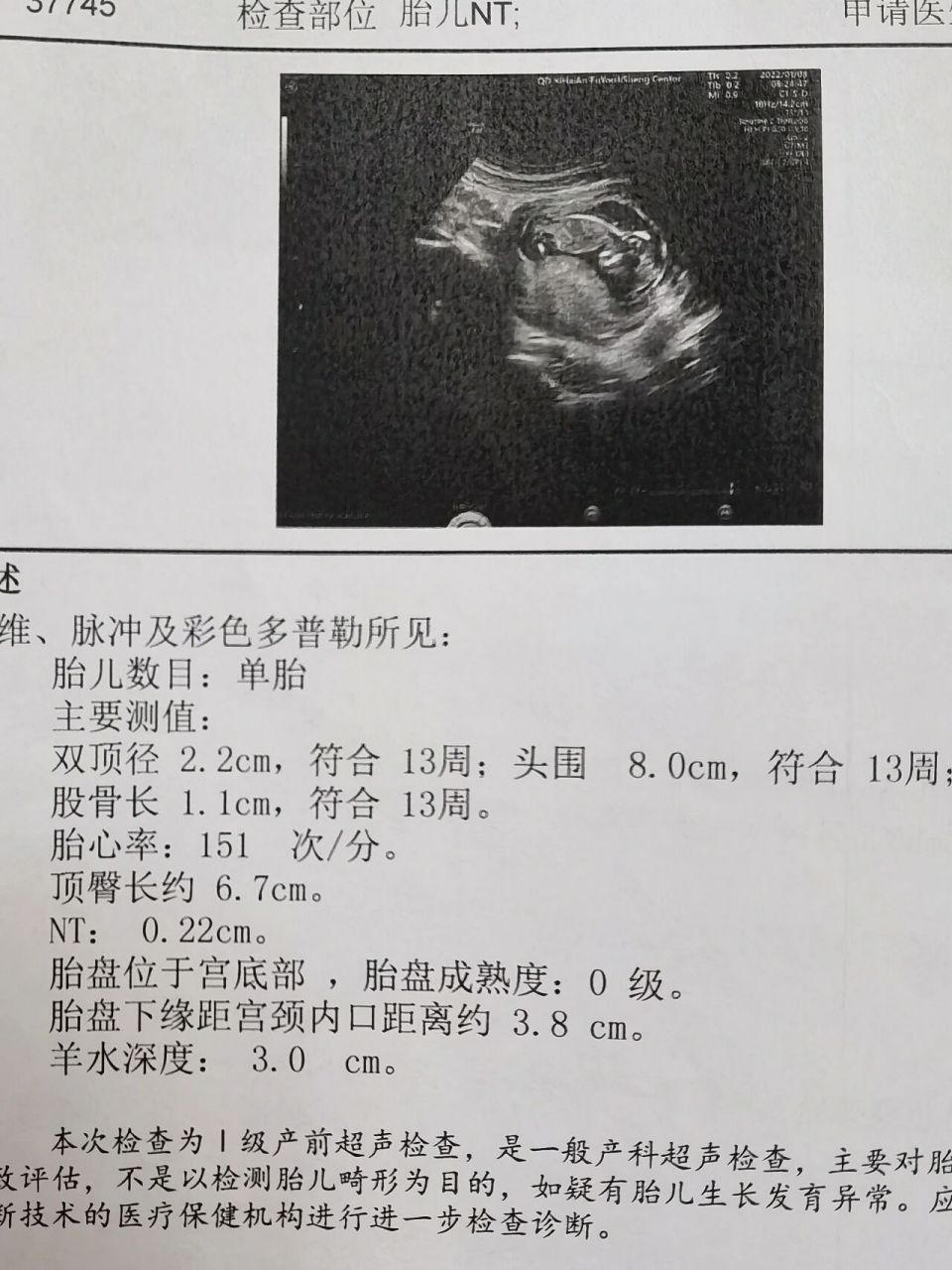 看了网上好多鉴别方法感觉都看糊涂了,,,男孩女孩都要,就是想验证