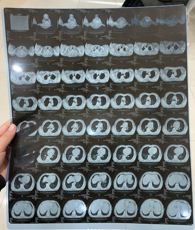 包含友谊医院黄牛检查加急代挂号说到必须做到的词条