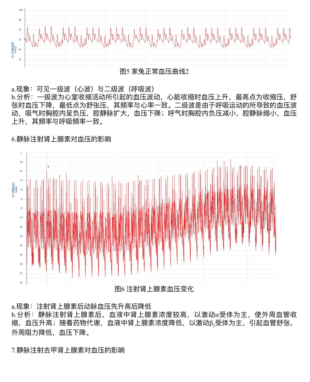 家兔正常血压曲线图图片