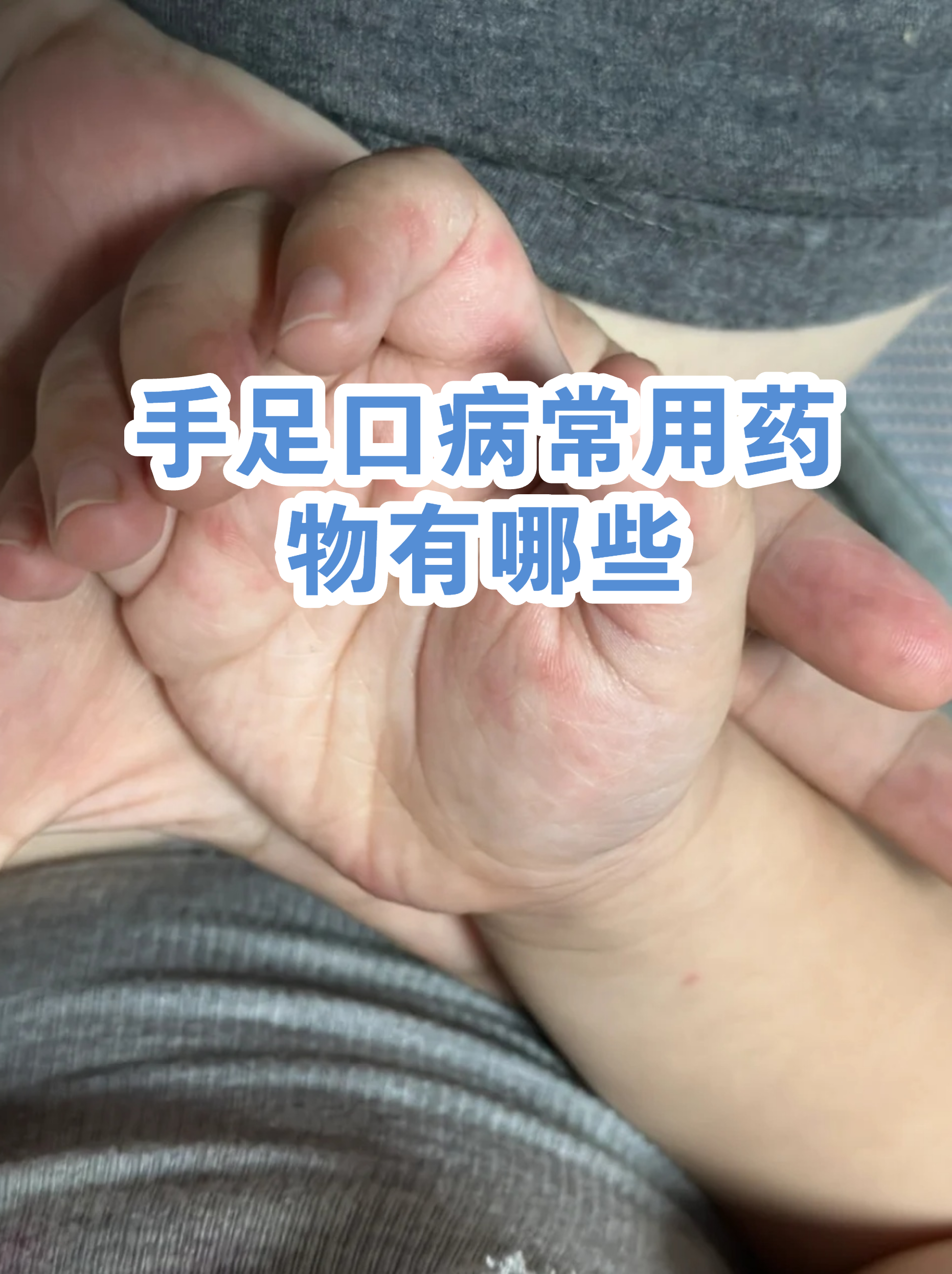  最近感染的病毒有什么症状与治疗(最近几天病毒感染情况)
