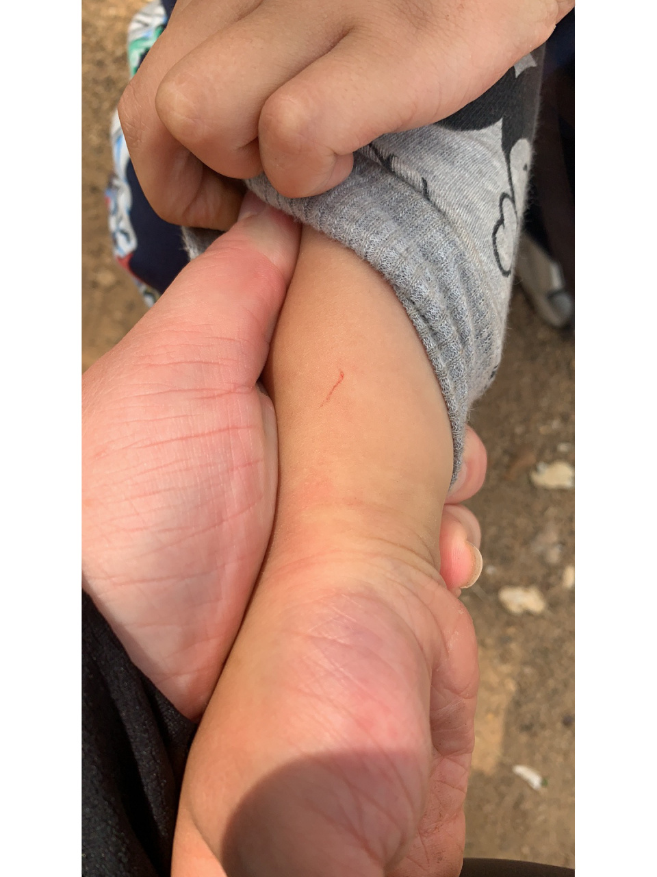 需要打疫苗吗 今天在南湾猴岛猴孩子被挠了一把,当地人说不用打疫苗