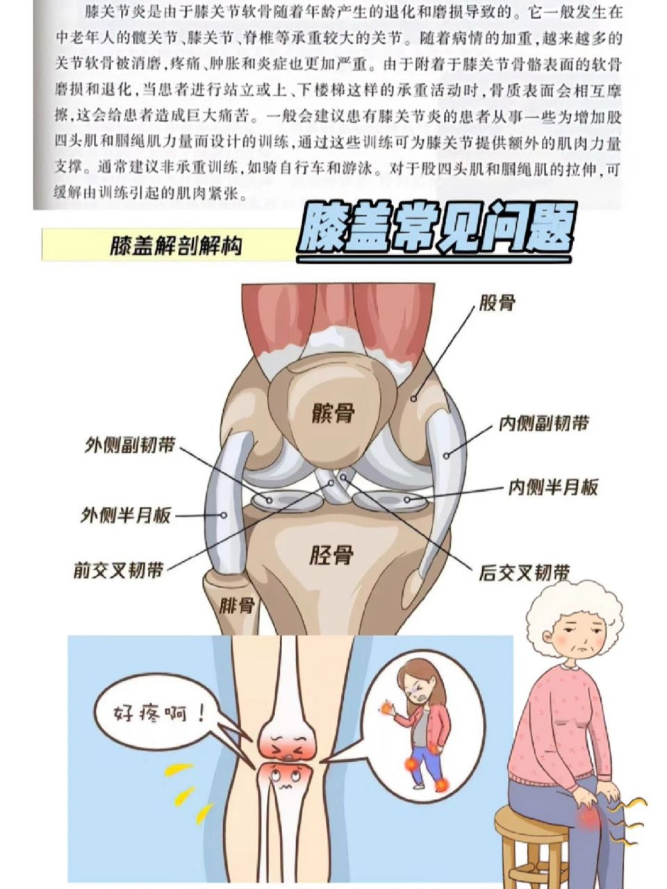膝关节疼痛的十大原因图片