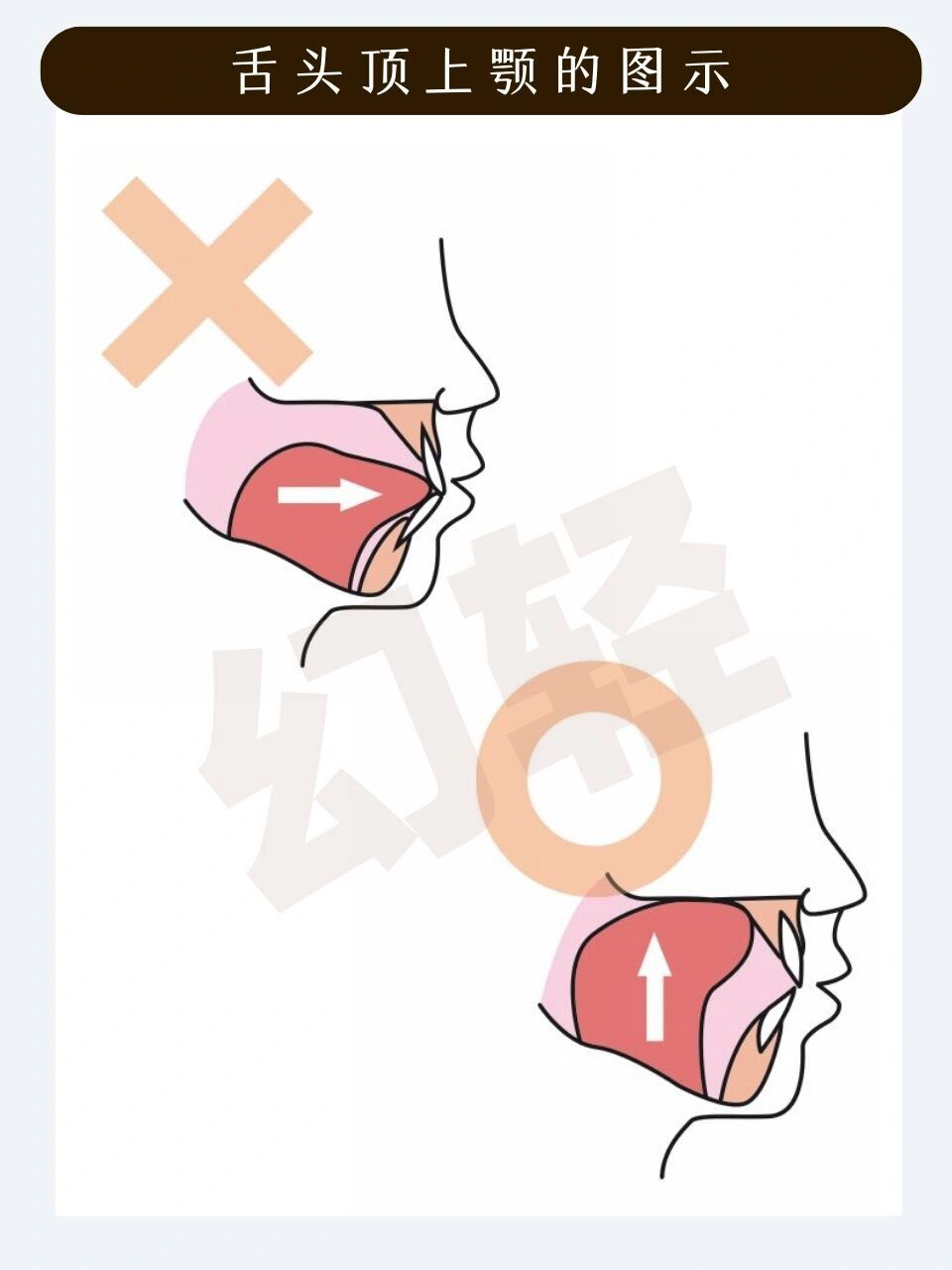 舌头如何顶上颚71