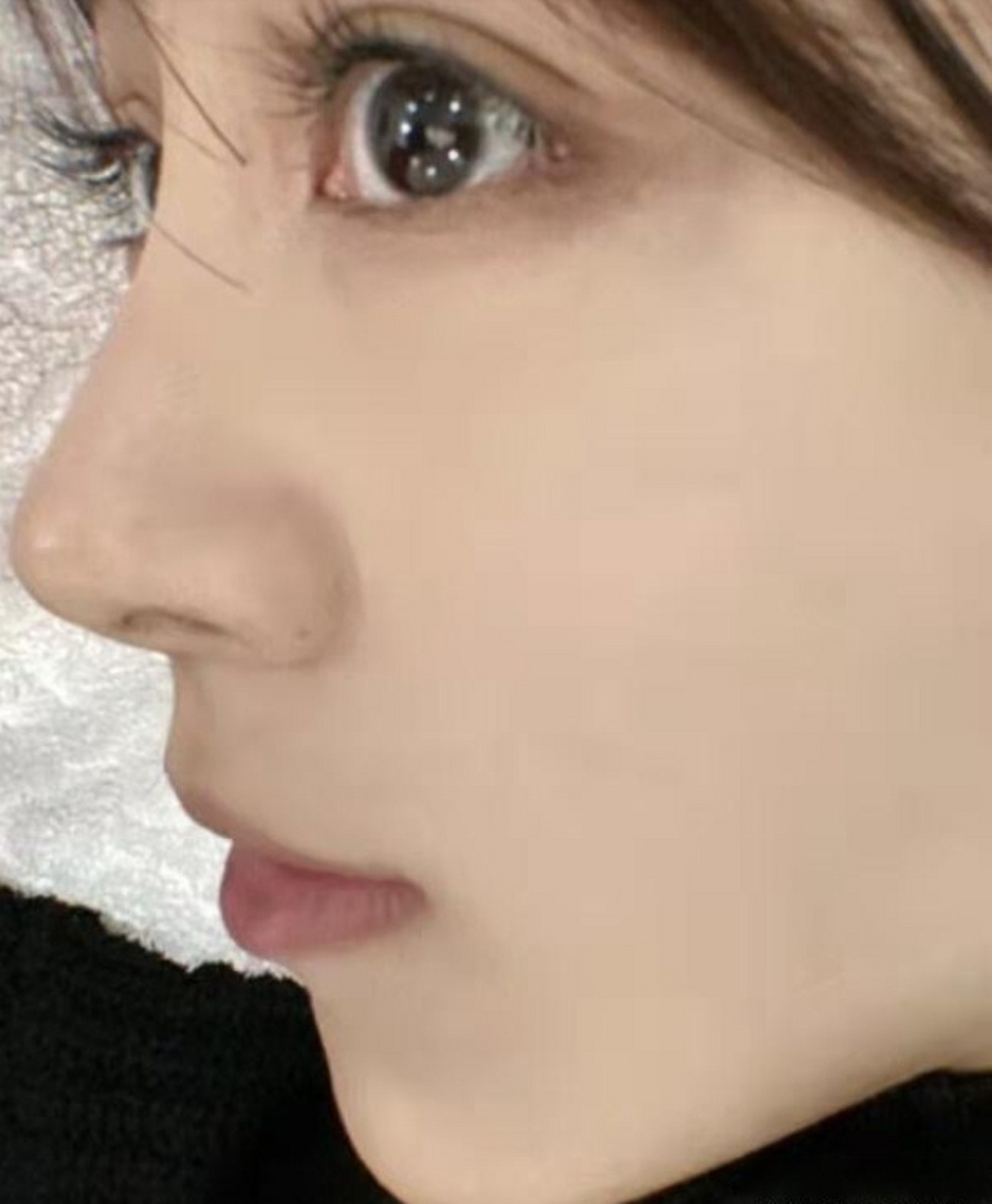 小翘鼻就是从侧面观看时,鼻尖相对于鼻梁来说会有微微翘起的形态