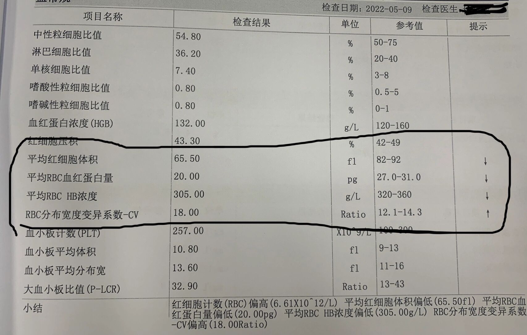 珠蛋白生成障碍性贫血图片