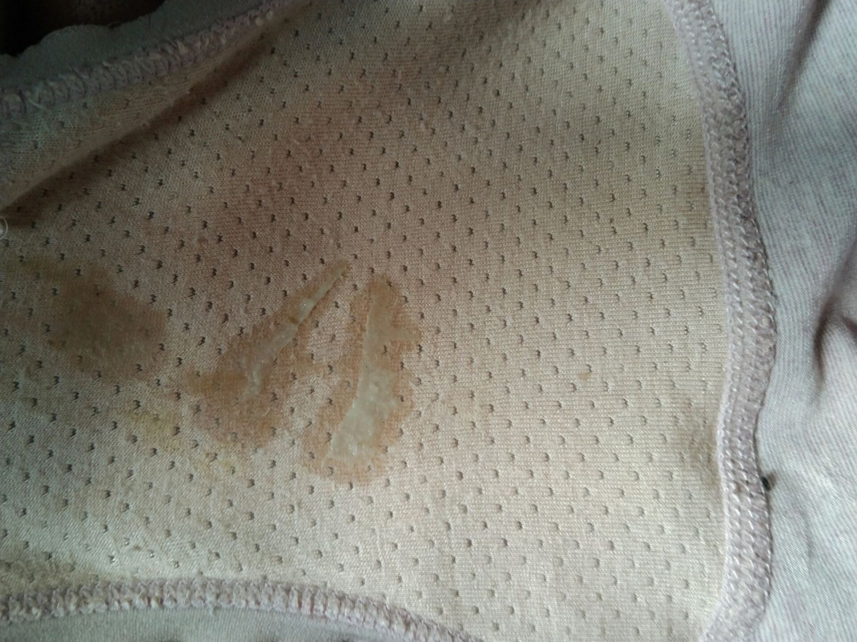 孕晚期 这种分泌物咋回事 这图片不知道能不能发