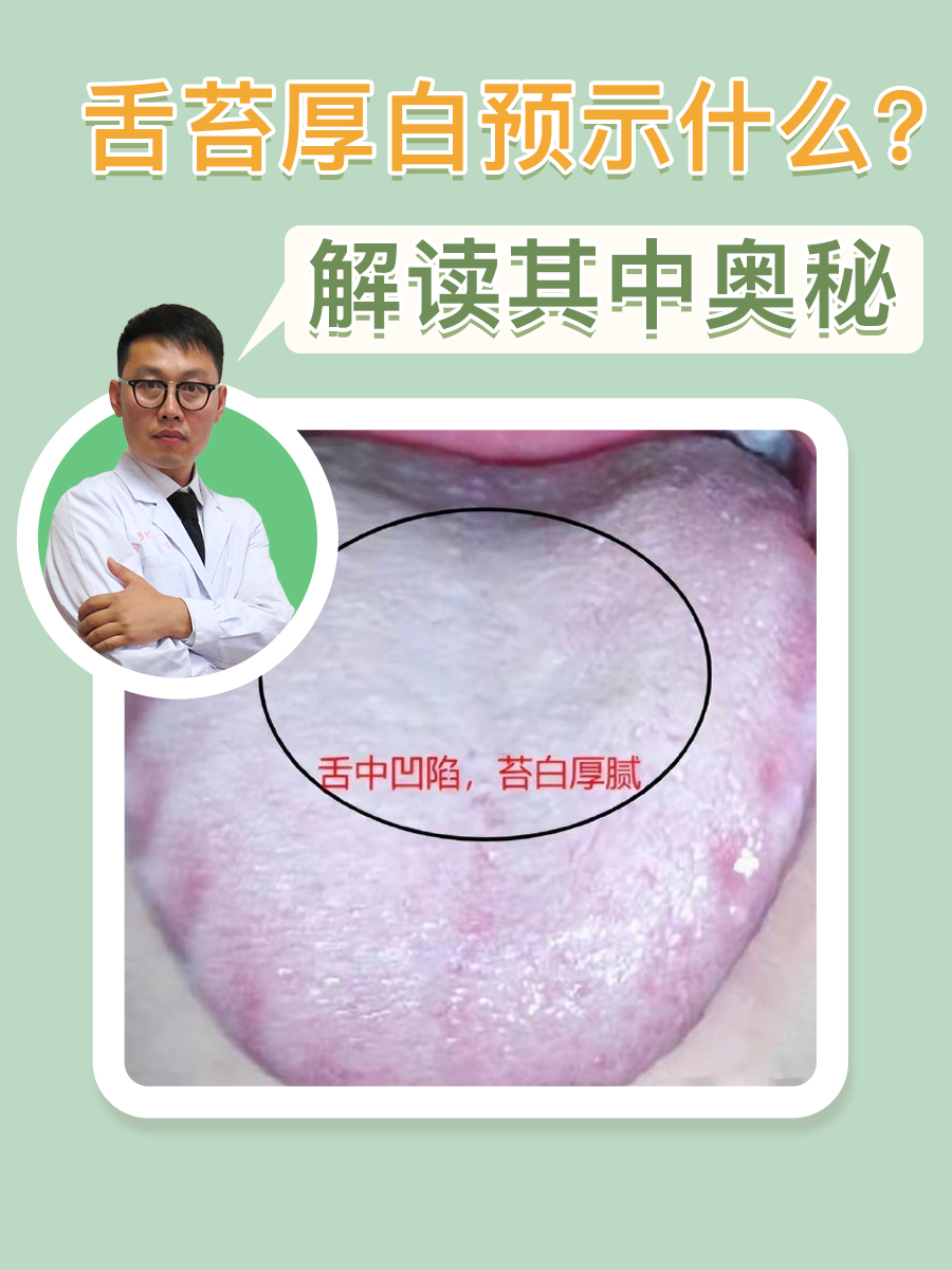 解读其中奥秘 舌苔厚白,这种现象在日常生活中并不罕见.