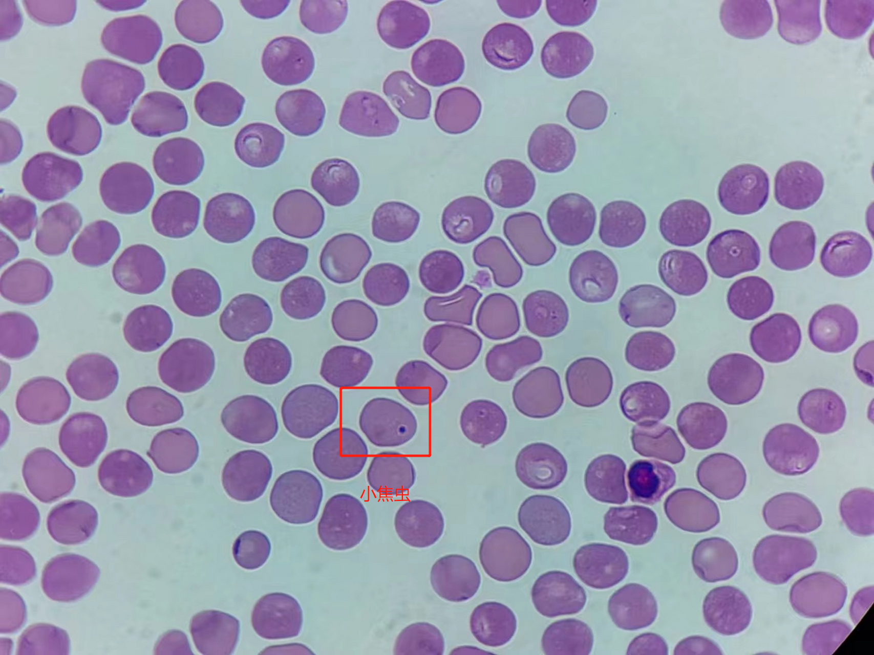多例巴贝斯虫的诊断治疗体会(一) 博主是宠物医生,有血虫醌(阿托伐坤)