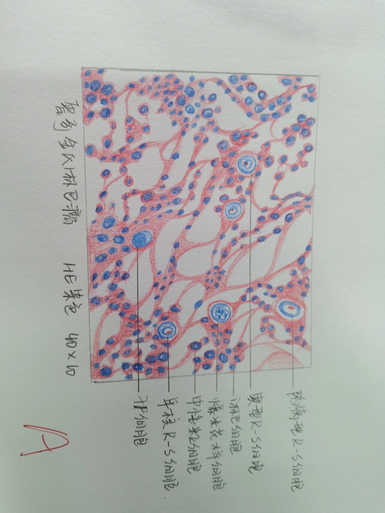 霍奇金细胞红蓝铅笔图图片