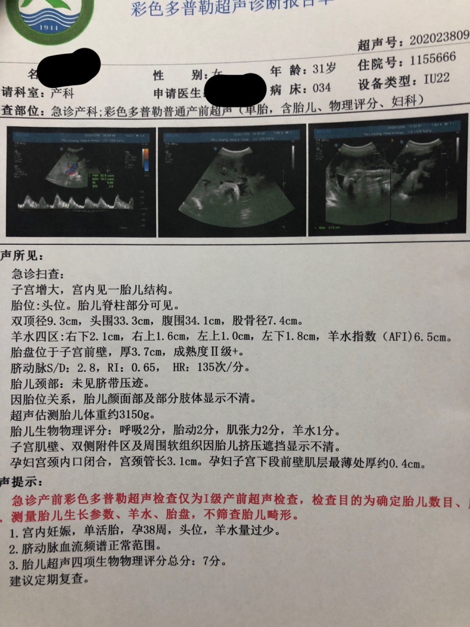 孕38周,羊水少,医生要我决定要不要催生 12月1日孕37周b超显示羊水