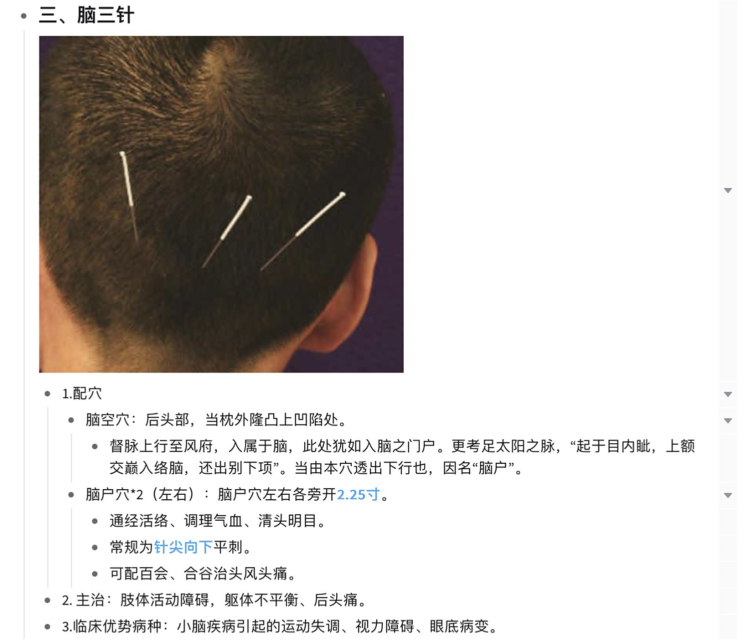 02靳三针-脑三针,舌三针