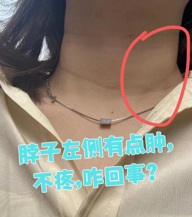 脖子往左扭为什么会痛 脖子往左扭为什么会痛