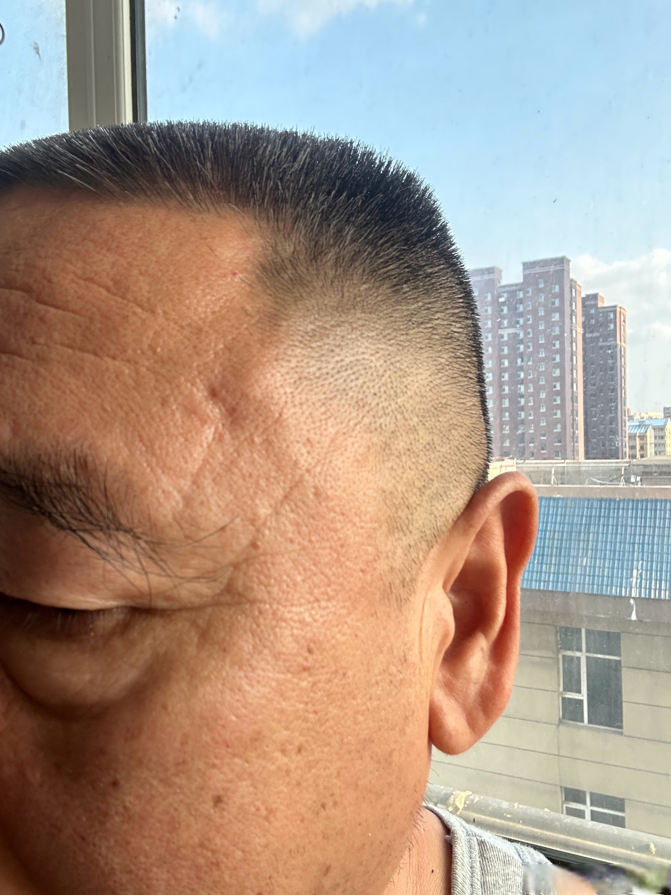 生活手记# 右侧额头上的两条纹路,开始变浅,错开