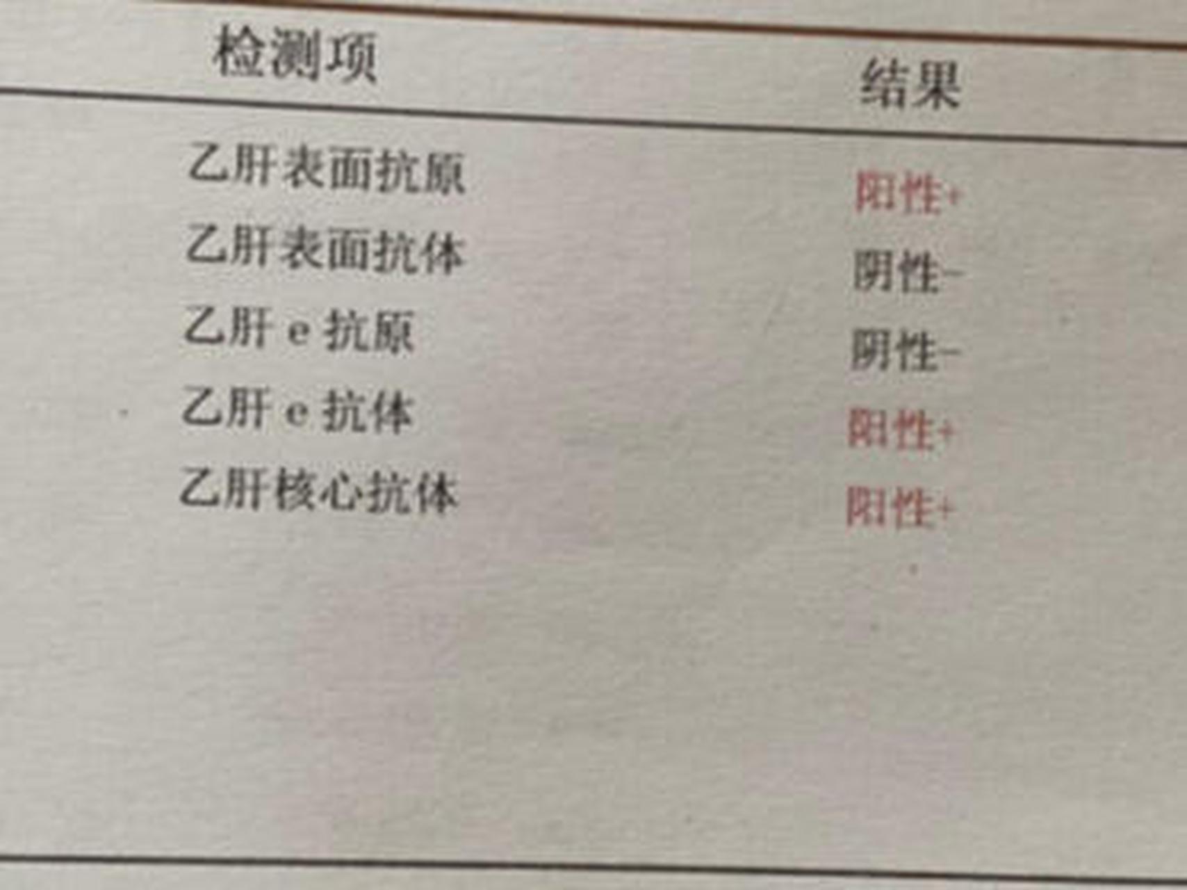 乙肝体检报告图片