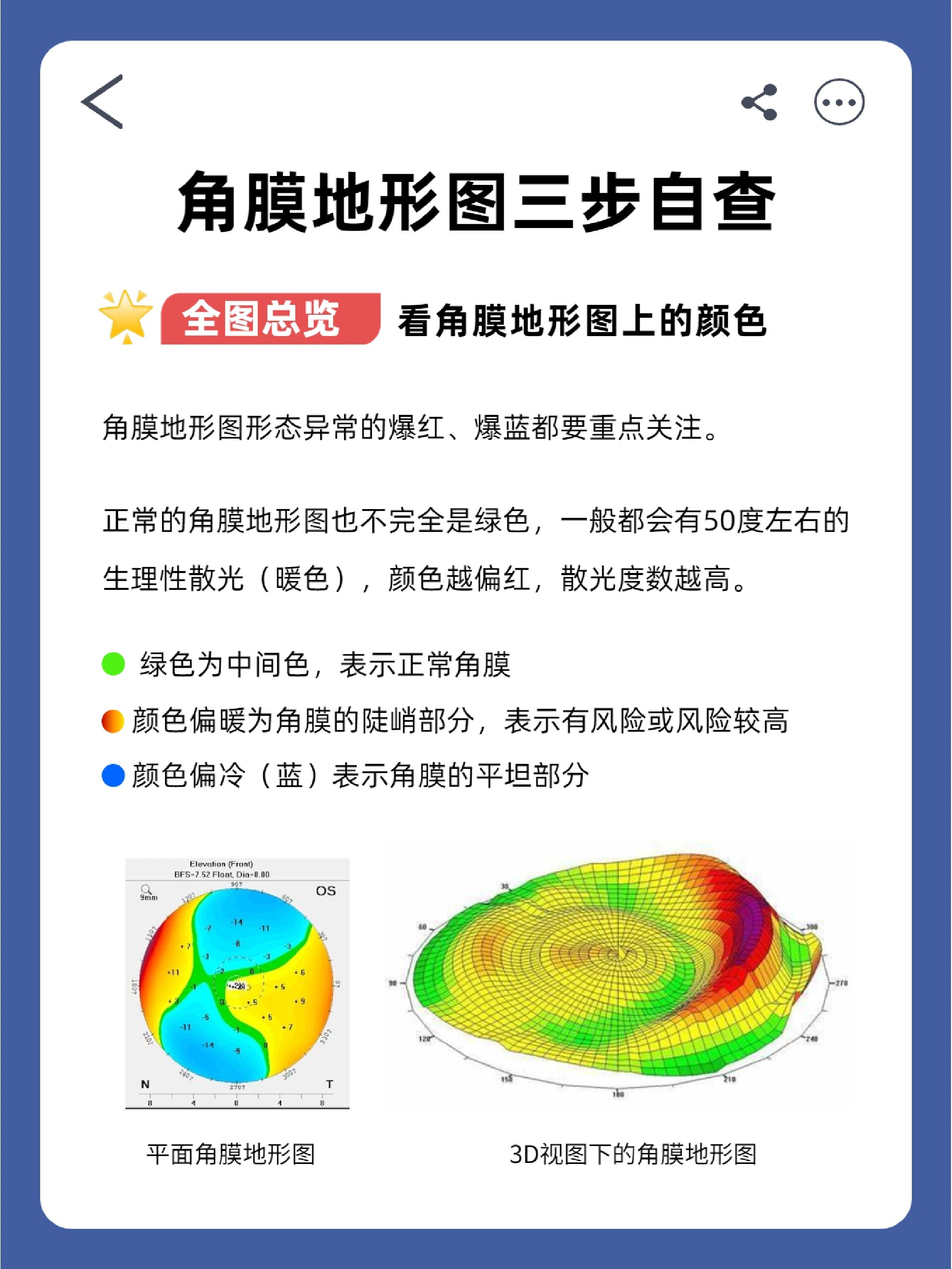 角膜地形图怎么看图片