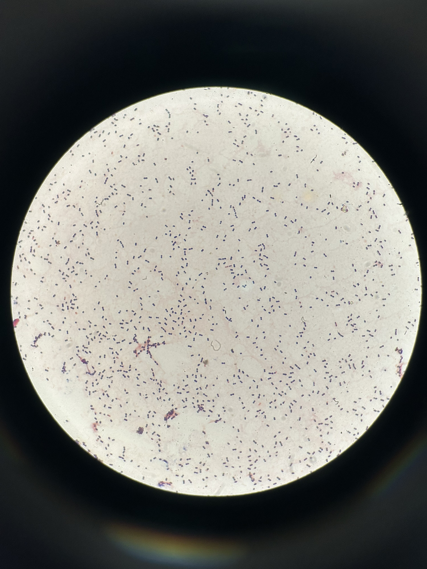 streptococcus pneumoniae 肺炎链球菌 - gram positive cocci.
