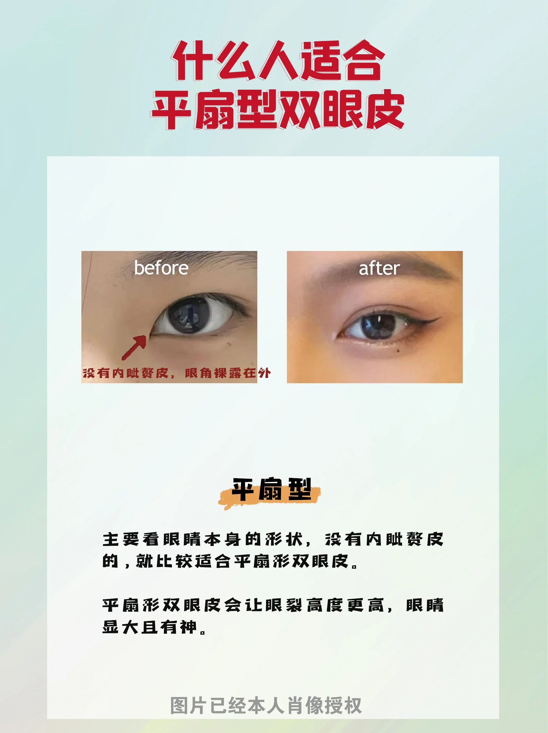 一招判断,你适合开扇型or平扇形双眼皮 大家都知道亚洲人更适合开扇型