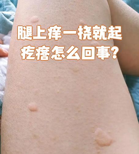 为什么小腿痒