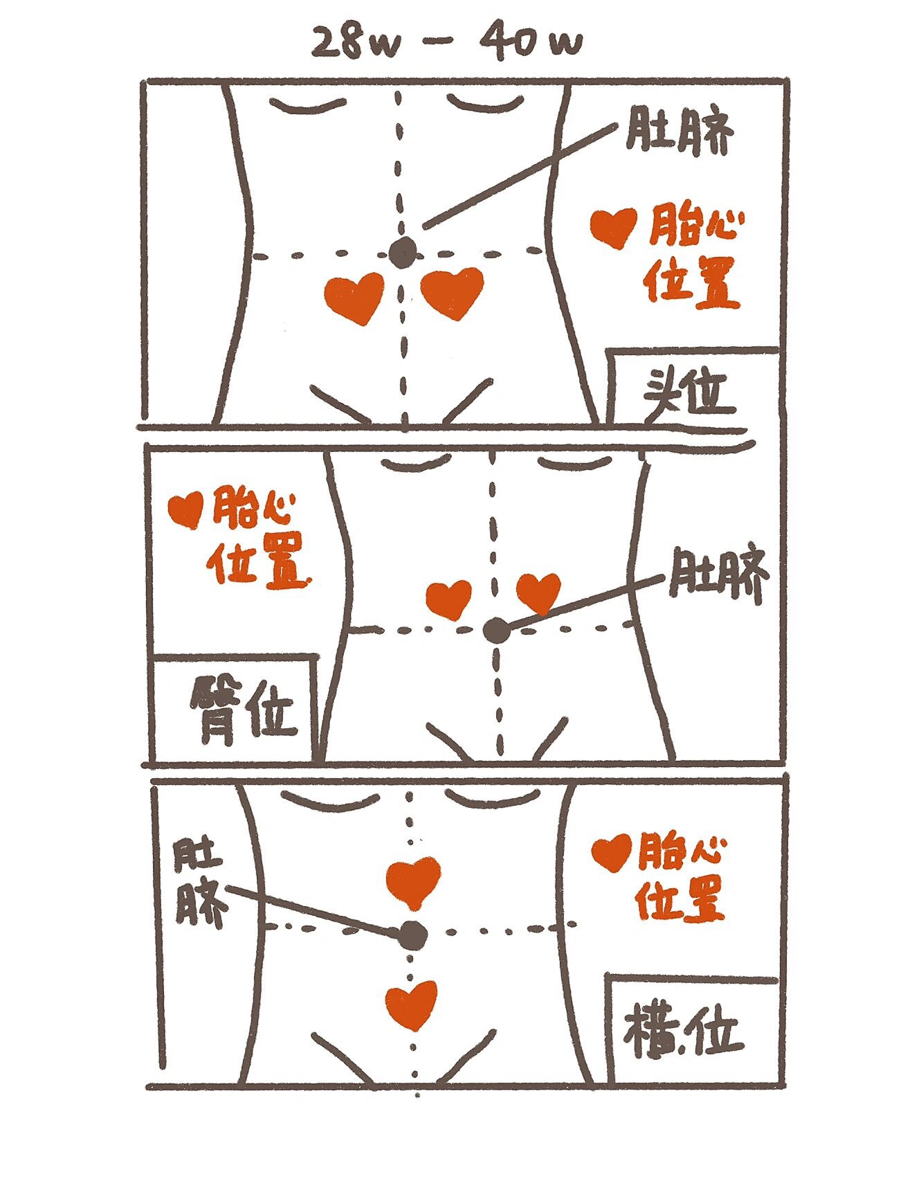 74拒绝焦虑| 孕期各种胎位找胎心秘诀91