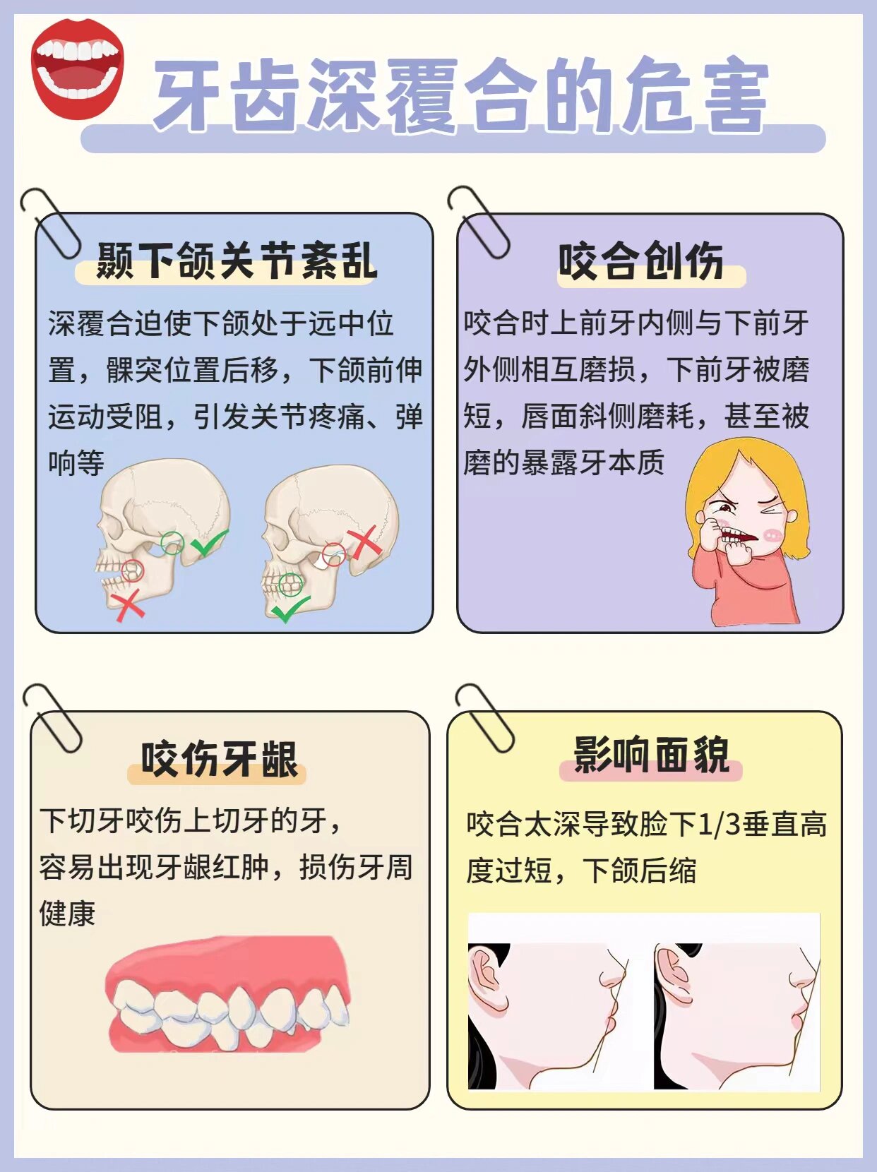 有哪些危害7215 深覆合相较于龅牙