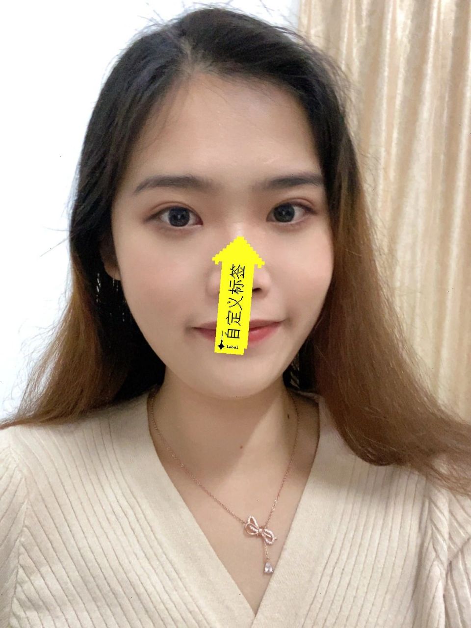 鼻横纹|少皱眉少生气保护嗓子|爱自己第一 照片发现鼻梁有一条纹路,害