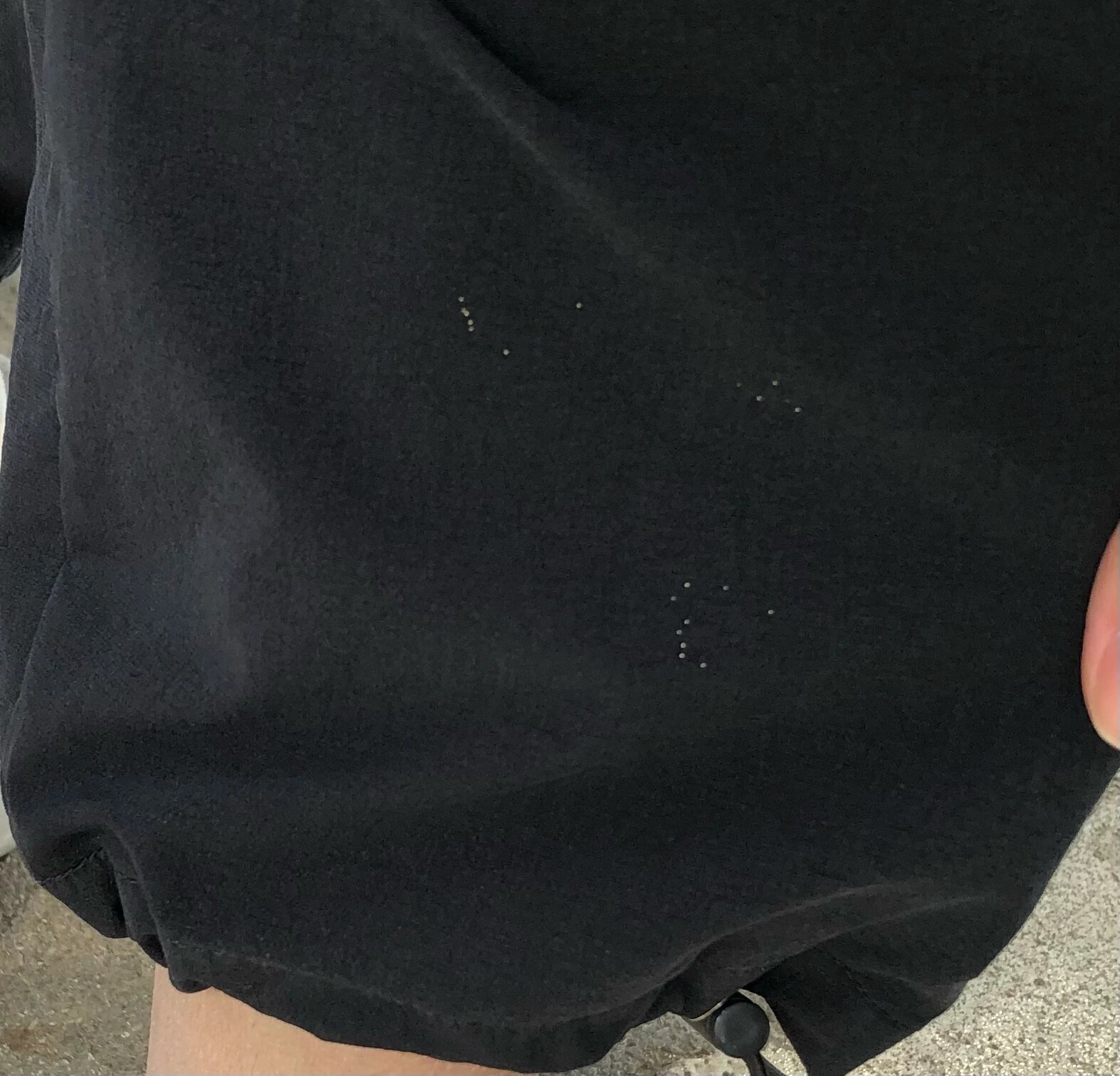 衣服上出现黄色点点 非虫卵!是蚊子屎