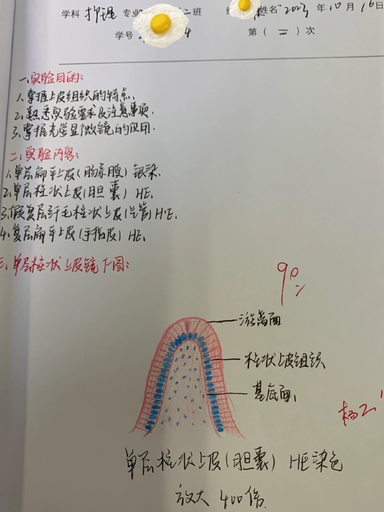 单层柱状上皮图片解析图片