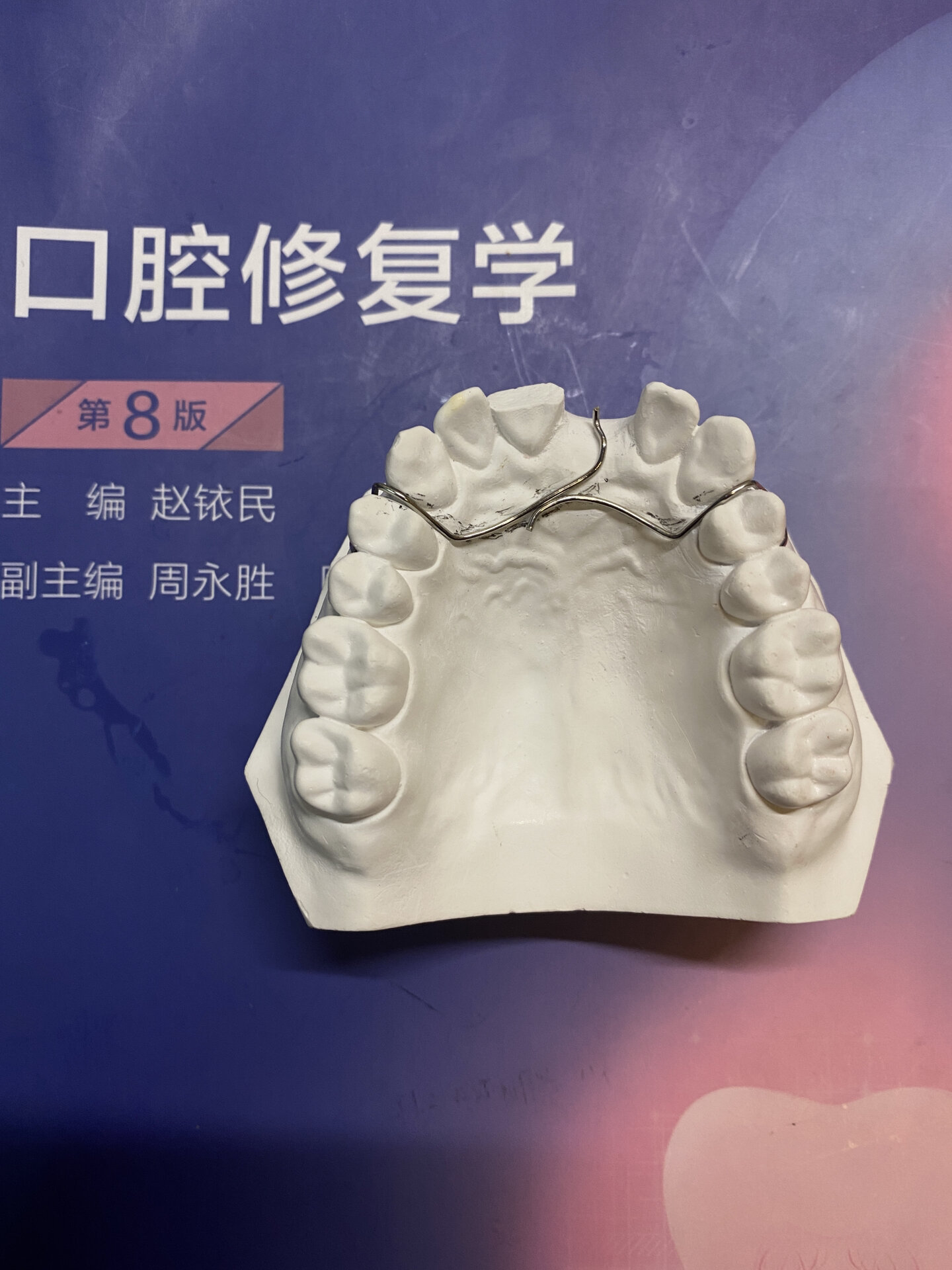间隙卡环弯制 经过两节课的弯制学习,终于有了大体的形态.
